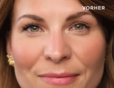 Vorher-Nachher-Ansicht zeigt den Unterschied zwischen ungeschwungenen und angehobenen Wimpern für einen offeneren und wacheren Blick.